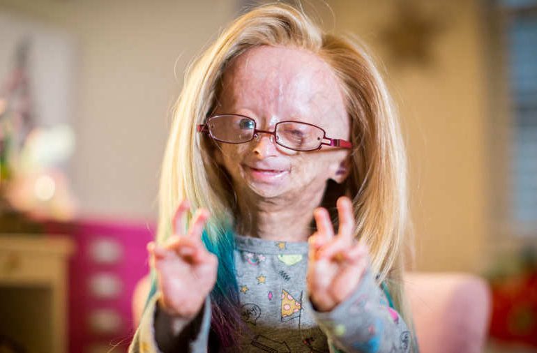 Adalia Rose